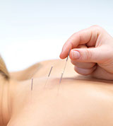 acupuncture on back